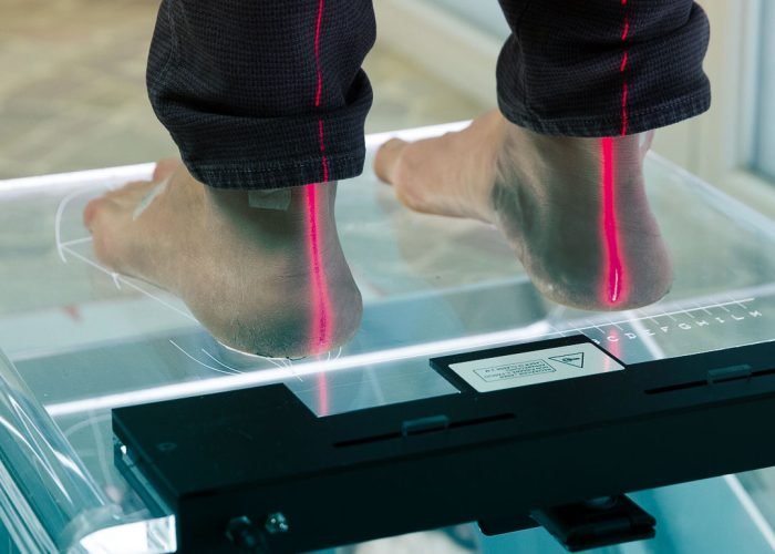 esame baropodometrico su pedana